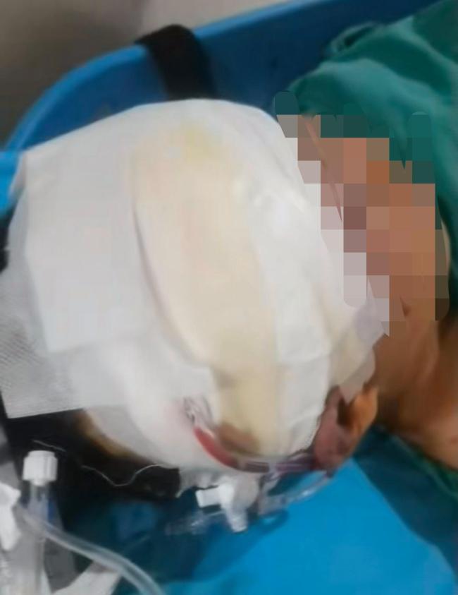 男生被打骨折右眼失明 教官被控制